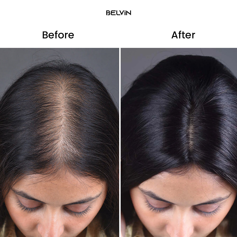 Silk Base Human Hair Topper 4.5*6Inc